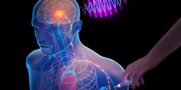 تراشههای بیوالکترونیکی MIT؛ درمان بیماریهای عصبی بدون جراحی
