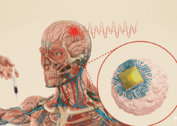 تزریق سیرکولاترونیکس به بدن