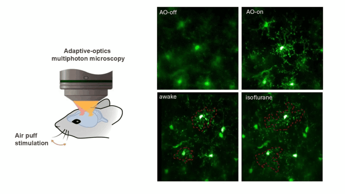 نتایج تصویربرداری از مغز با میکروسکوپ سه‌فوتونی