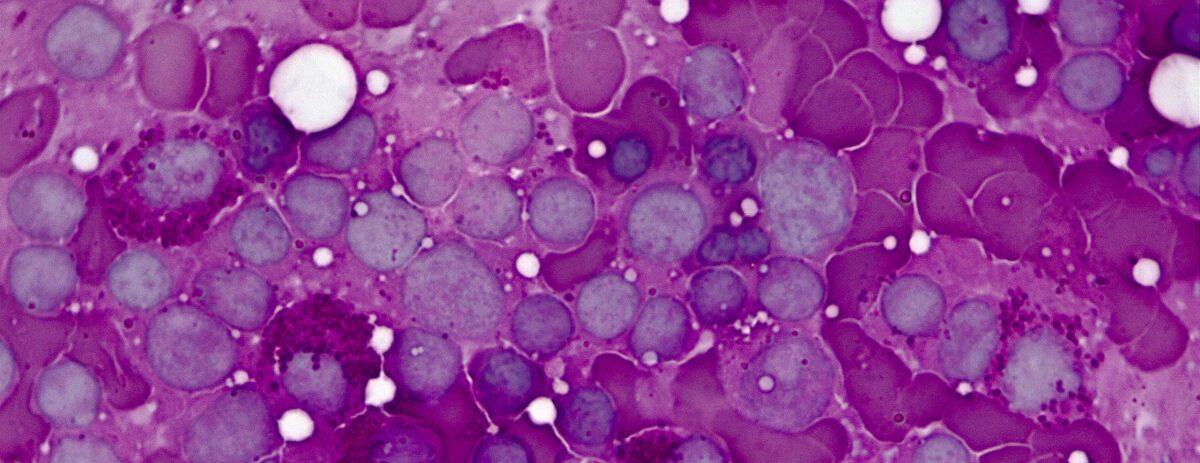 ساخت مدل واقعی از مغز استخوان انسان برای اولین بار 