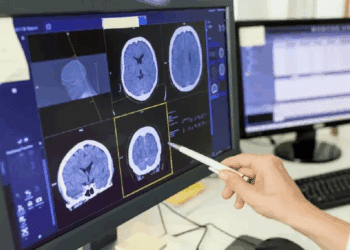 کنترل تشنج با ترکیب امواج صوتی و ژن‌درمانی