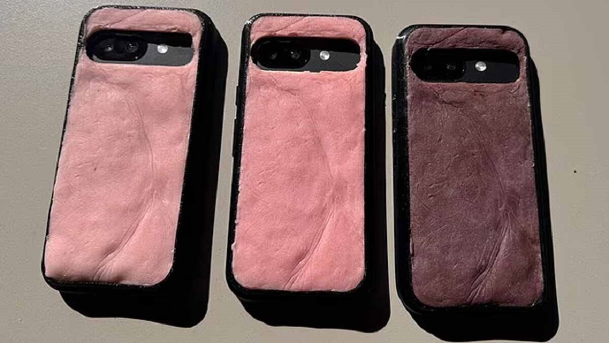 Skincase: قاب گوشی که شبیه پوست انسان آفتاب‌سوخته می‌شود