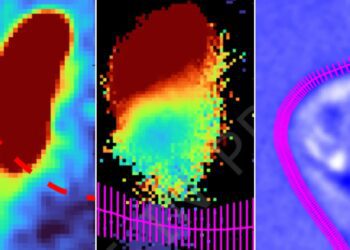 برای اولین بار اتم اکسیژن حل‌شده در آب با کمک لیزر فوق سریع به‌ دام افتاد