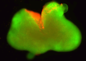 ساخت پیشرفته‌ترین ارگانوئید نخاعی انسان برای بازگرداندن توانایی حرکت به بیماران