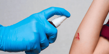 اسپری هموستاتیک جدیدی که خون‌ریزی شدید را در کسری از ثانیه متوقف می‌ کند