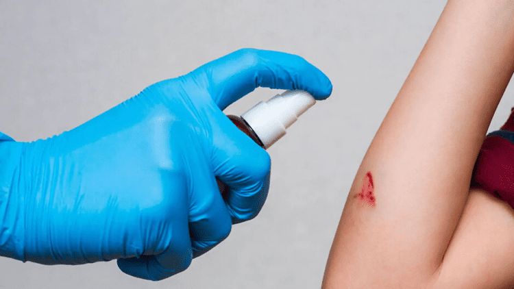 اسپری هموستاتیک جدیدی که خون‌ریزی شدید را در کسری از ثانیه متوقف می‌ کند