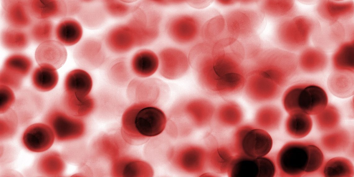 سلول‌های بنیادی خون‌ساز