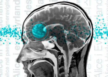 مناطق زبانی در مغز