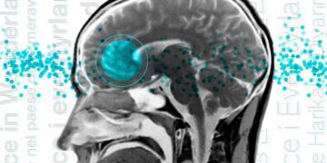 مناطق زبانی در مغز