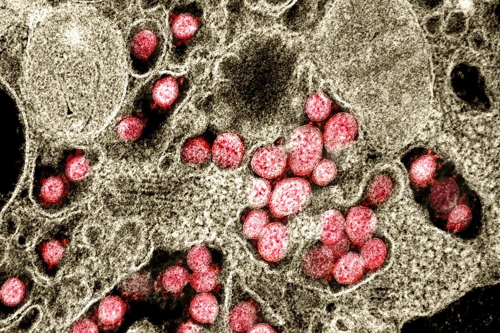 یک فیزیکدان در دانشگاه کالیفرنیا، ریورساید، و دانشجوی سابقش برای اولین بار با موفقیت فرایند شکل گیری ویروس کرونا، SARS-CoV-2، را مدل سازی کردند.