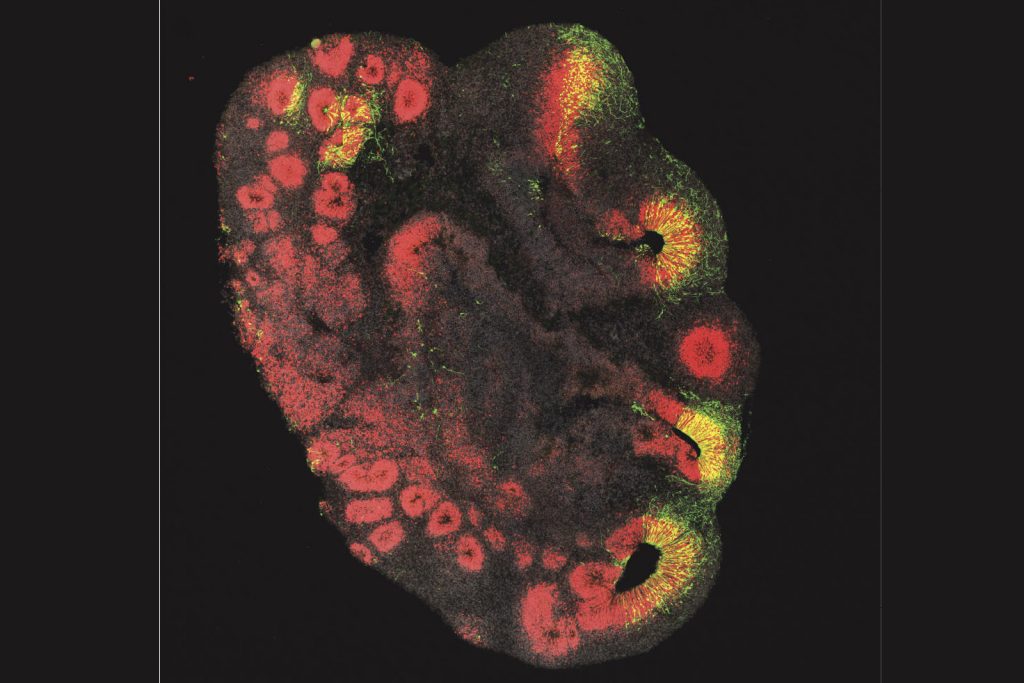 یک ارگانوئید مغزی به اندازه حدود 3 میلی متر که از سلول های بنیادی یک شامپانزه ساخته شده است. سلول های بنیادی مغز قرمز رنگ می شوند. سلول های بنیادی مغزی که ژن ARHGAP11B را دریافت کرده اند به رنگ سبز نشان داده شده اند.