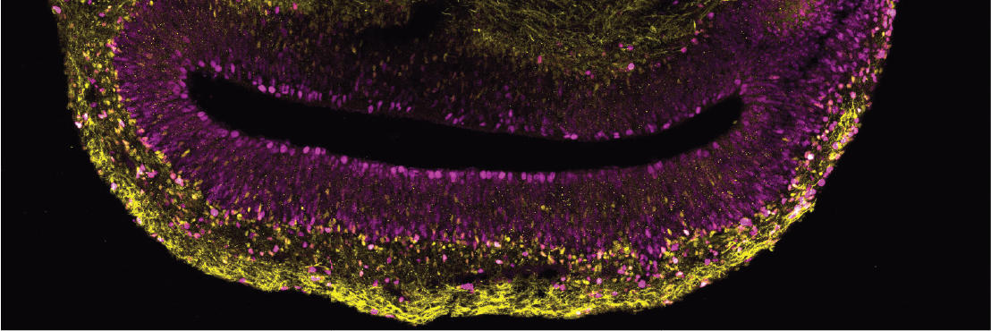 بخشی از یک ارگانوئید مغز ساخته شده از سلول های بنیادی یک انسان. در سرخابی سلول های بنیادی مغز به طور فعال تکثیر می شوند و در رنگ زرد زیر مجموعه ای از سلول های بنیادی مغز