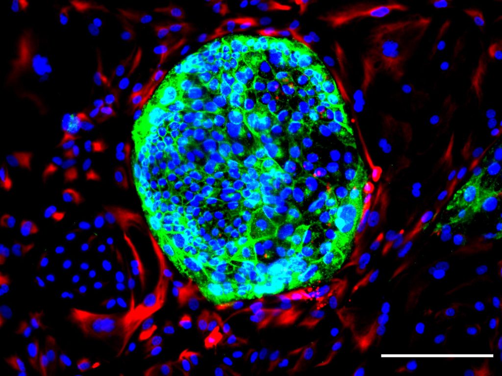 تصویر میکروسکوپ فلورسنت از سلول های بنیادی جدید (سلول های مزودرم خارج جنینی) و سلول های بنیادی پیش ساز جفت. سلول های جدید با رنگ قرمز مشخص شده اند و سلول های مربوط به سلول های بنیادی جفت به رنگ سبز نشان داده شده اند. DNA (هسته) هر سلول با رنگ آبی نشان داده شده است.