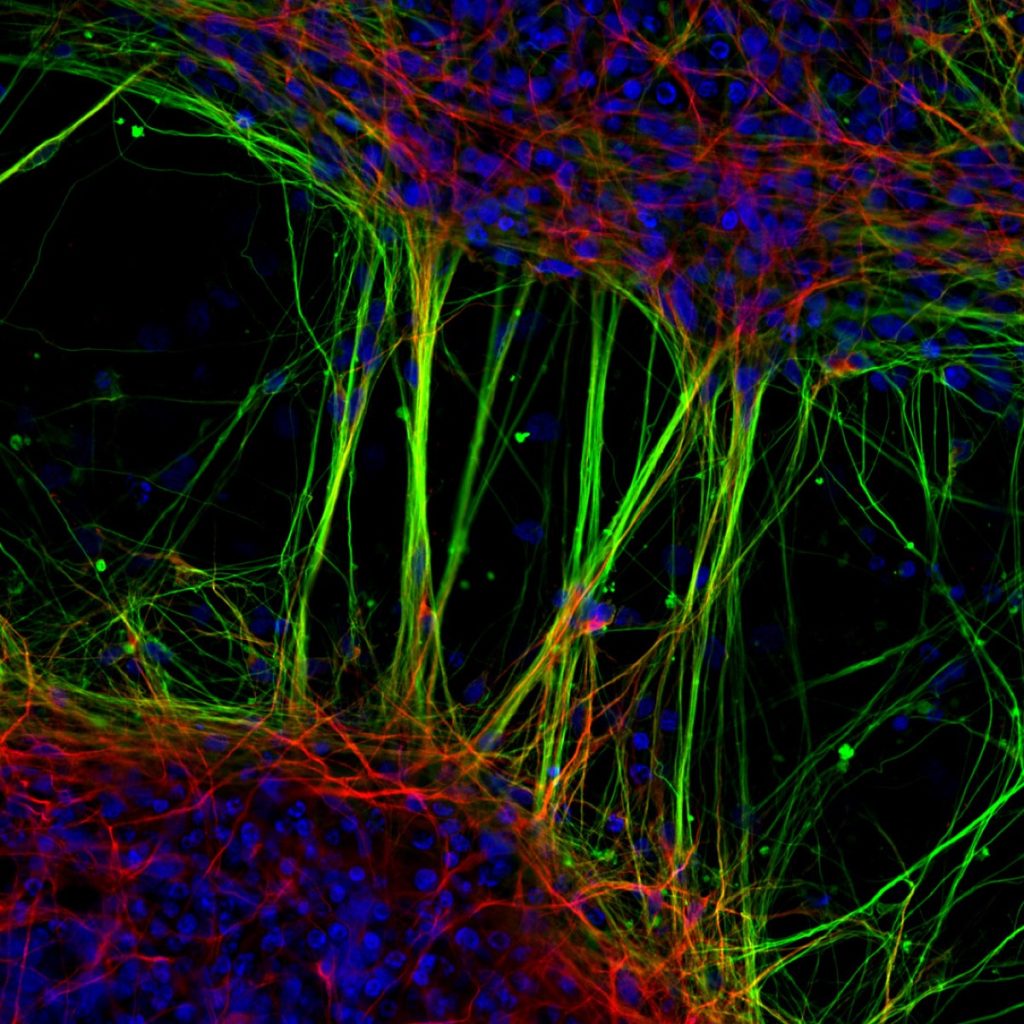 Jianqun Gao و Glenda Halliday، دانشگاه سیدنی، استرالیا: "نرون های انسانی مشتق شده از سلول های بنیادی عصبی."