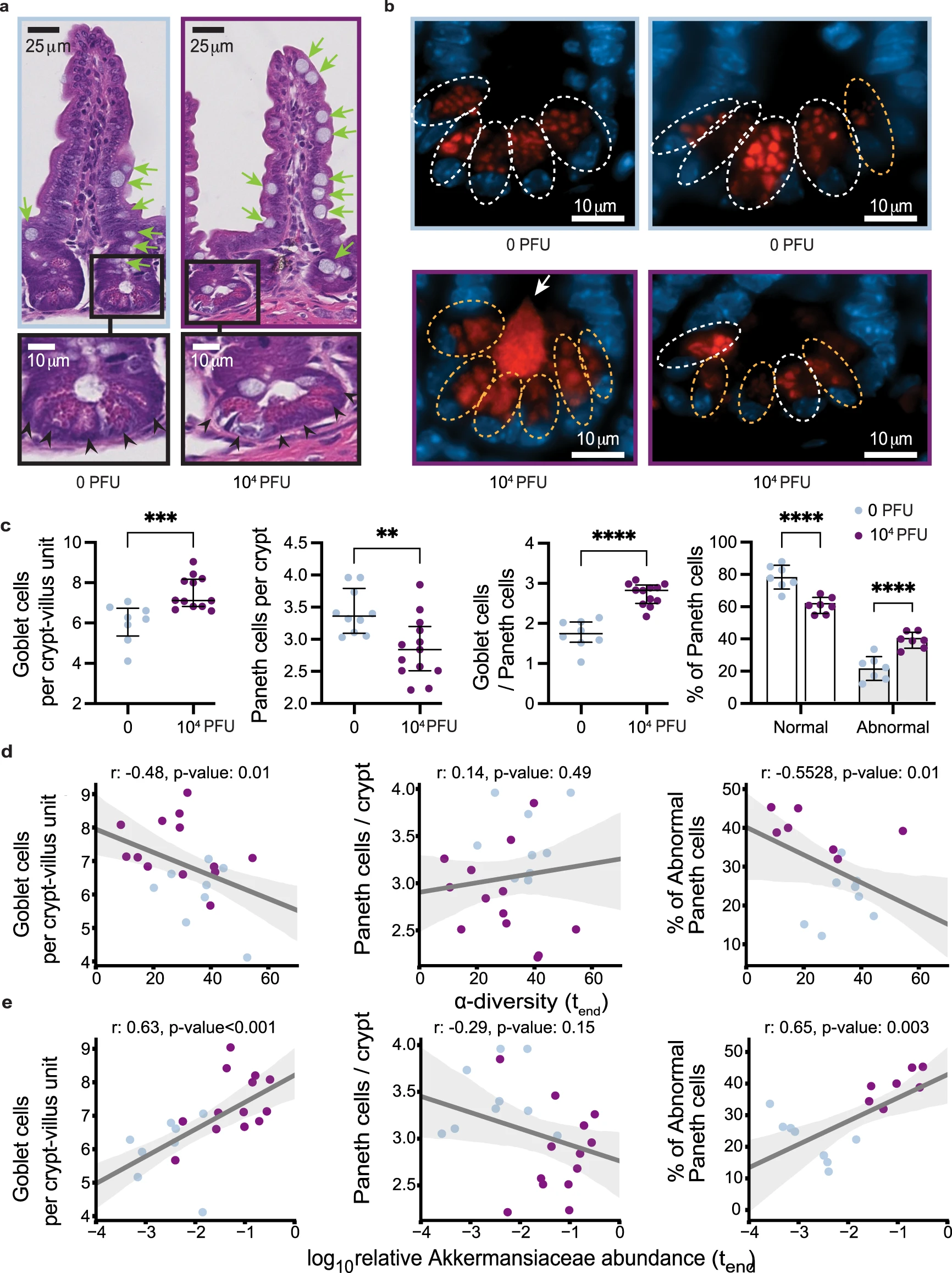 شکل 2: عفونت SARS-CoV-2 باعث ایجاد ناهنجاری در اپیتلیوم روده موش می شود.