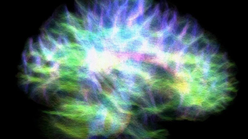 تصویری از «نمودار سیم‌کشی» مغز انسان که ارتباط با هیپوکامپ را نشان می‌دهد.