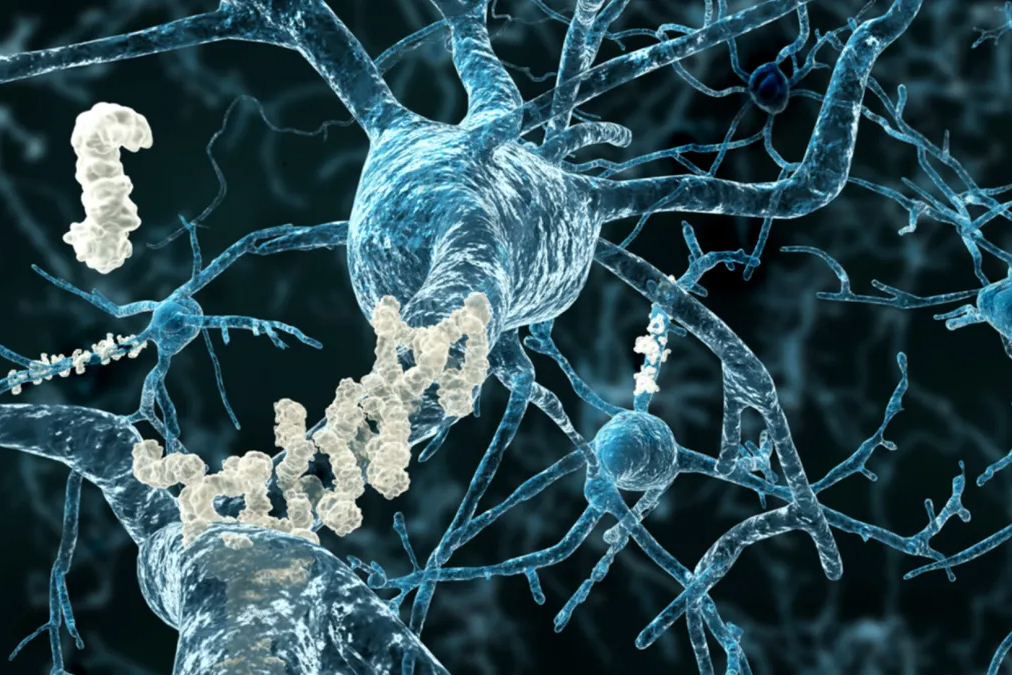 محققان موفق شدند ژنی که باعث می شود بیماری آلزایمر، مغز را به شدت تحت تاثیر قرار دهد را کشف کردند.