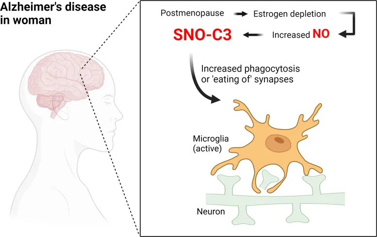 در زنان یائسه، کاهش استروژن باعث افزایش بیش از حد اکسید نیتریک (NO) در مغز می شود و در نتیجه فاکتور مکمل C3 S-نیتروسیله (SNO-C3) تولید می کند. SNO-C3 سلول‌های میکروگلیال فعال، سلول‌های ایمنی ذاتی در مغز را تحریک می‌کند تا سیناپس‌های عصبی را فاگوسیتوز کنند (یا «خوردن») - ارتباطاتی که واسطه سیگنال‌دهی بین سلول‌های عصبی در مغز هستند. این فرآیند بیولوژیکی شیمیایی نابجا منجر به از دست دادن سیناپس می شود که منجر به کاهش شناختی در بیماری آلزایمر می شود. اعتبار: چانگ کی اوه و استوارت لیپتون، پژوهش اسکریپس
