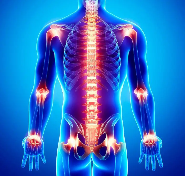 فراوانی بیش از حد حس مکانیکی در نورون‌ ها می‌تواند رشد اسکلتی- عضلانی را مختل کرده و باعث بدشکلی های مفصلی مانند آرتروگریپوز شود.
