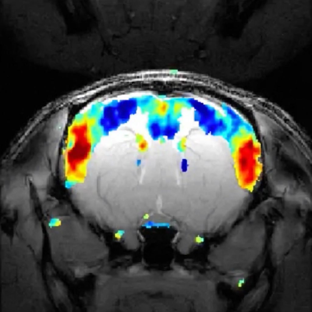 بیش از 20 سال از تحقیق بر روی تصویربرداری عصبی با استفاده از تکنیک تصویربرداری تشدید مغناطیسی عملکردی (fMRI) می گذرد.