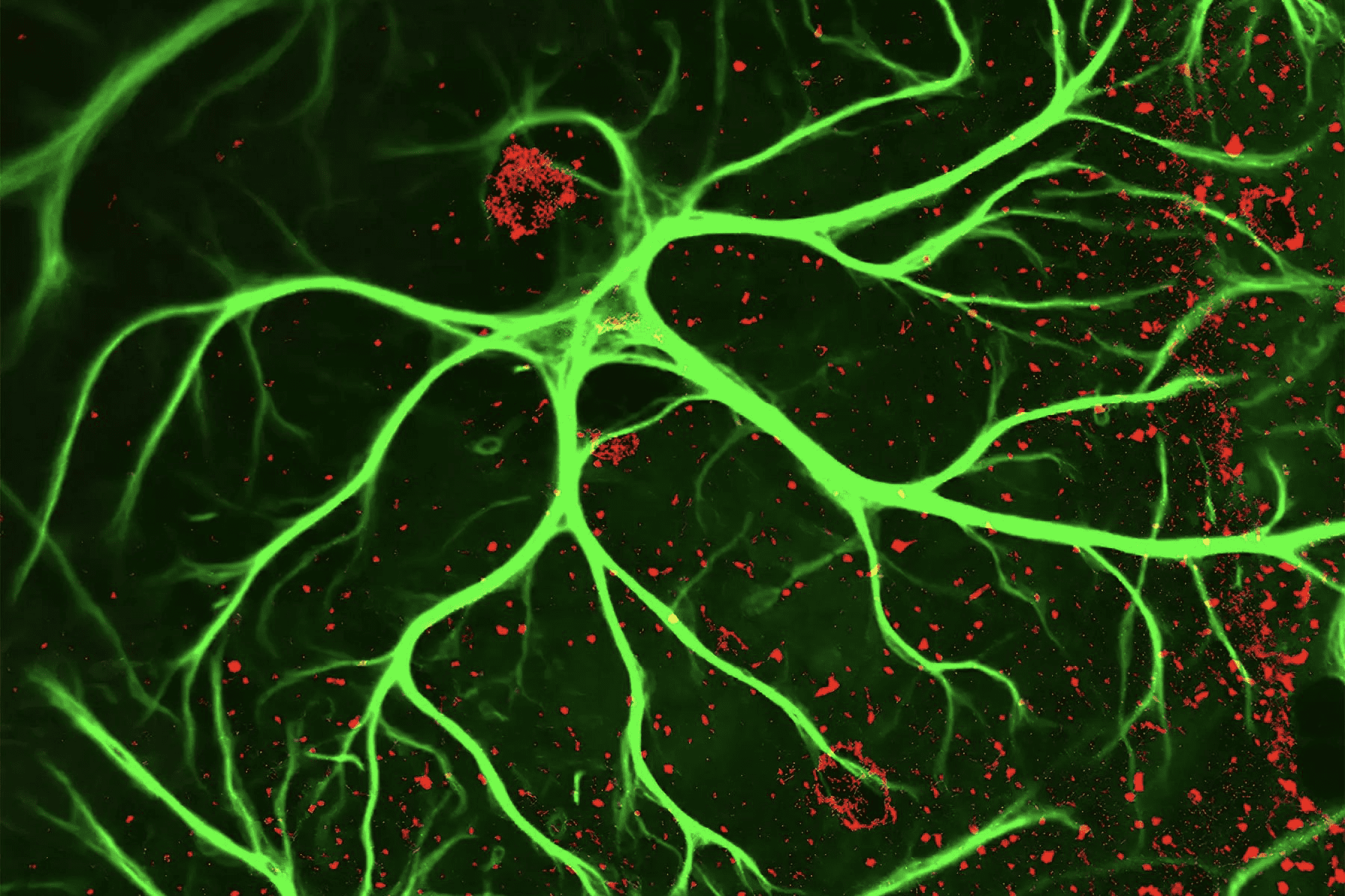 دانشمندان در دانشگاه نورث وسترن کشف کرده‌اند که اکتوپامین، که یک انتقال‌دهنده عصبی است و به مقدار کمی در پستانداران وجود دارد، با سلول‌های مغز تعامل می‌کند تا از مرگ سلولی جلوگیری کند.