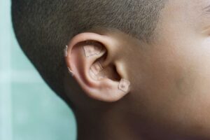 بذردرمانی گوش که گاهی به آن طب فشاری گوش نیز می گویند، یک روش غیرتهاجمی است که نقاط فشار روی گوش را تحریک می کند.