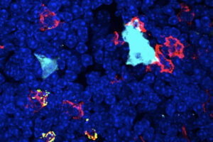 سلول های تیموس در موش را نشان می دهد. هسته تمام سلول های موجود آبی تیره، سلول های M فیروزه ای و سلول های B (لنفوسیت ها) قرمز یا قرمز/سبز هستند