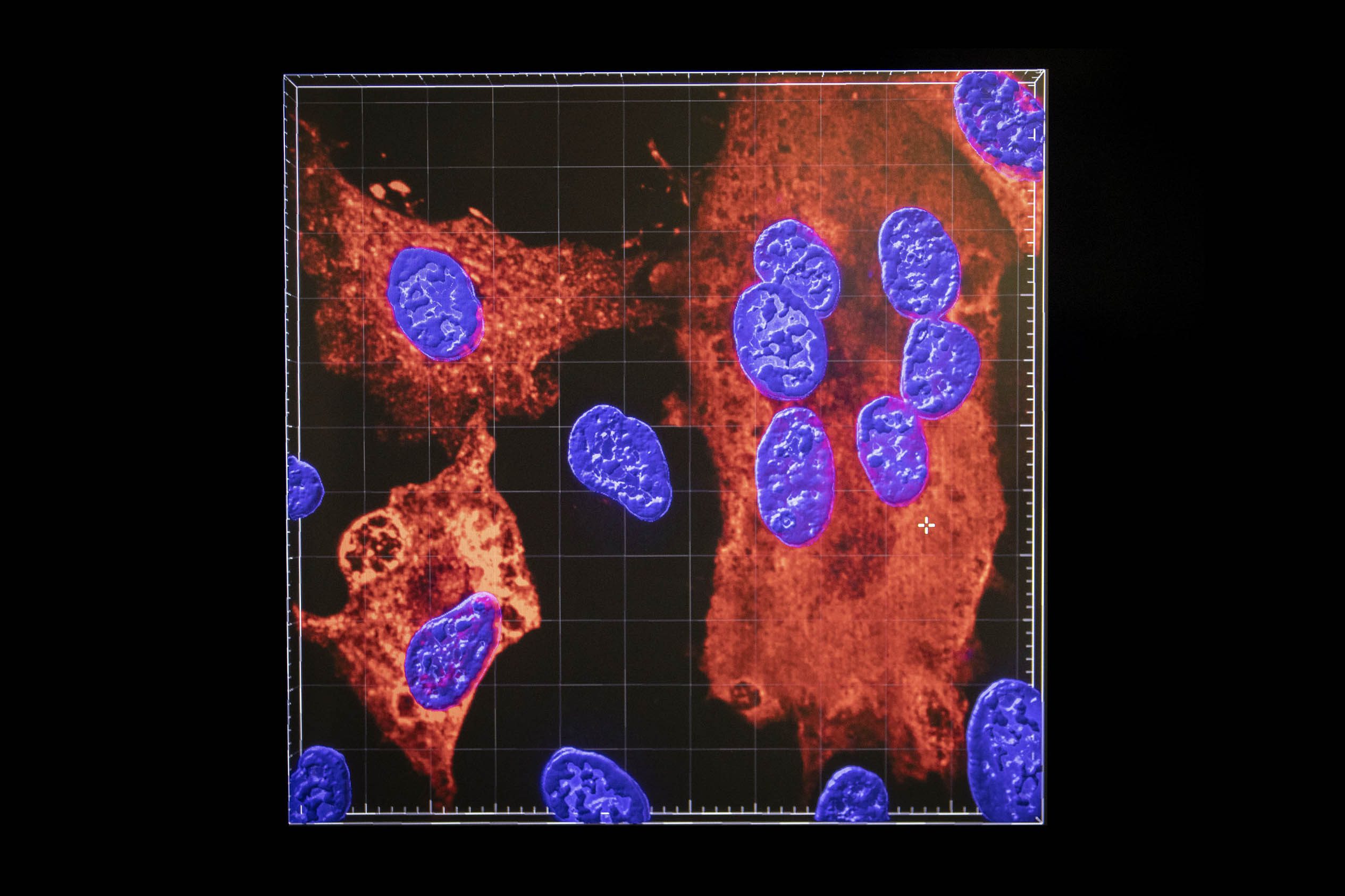 An image created with a confocal microscope shows cell nuclei (blue) being infected by SARS-CoV-2 (red areas), the virus which causes COVID-19, in the Richard Elliott Biosafety Laboratories (REBL), Containment Level 3 Facilities, at the MRC-University of Glasgow Centre for Virus Research. Picture date: Tuesday March 16, 2021. (Photo by Jane Barlow/PA Images via Getty Images)
