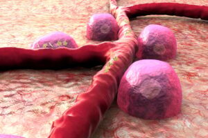 پژوهشگران به‌تازگی سلول های پانکراس آسیب دیده توسط دیابت را بازسازی کرده و آنها را برای تولید انسولین برنامه ریزی مجدد کردند