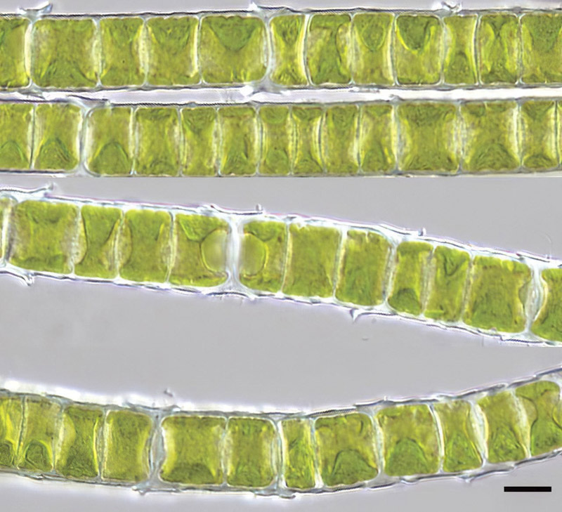 تصویر میکروسکوپی از جلبک رشته ای Klebsormidium crenulatum که یک جلبک ساکن خشکی است که به دلیل دیواره سلولی ضخیم خود در برابر خشک شدن بسیار مقاوم است