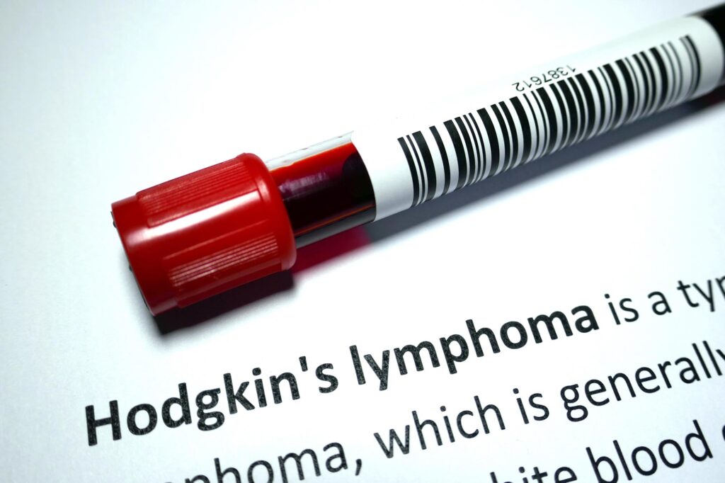 درمانی امیدوارکننده برای بیماری لنفوم هوچکین کشف شد