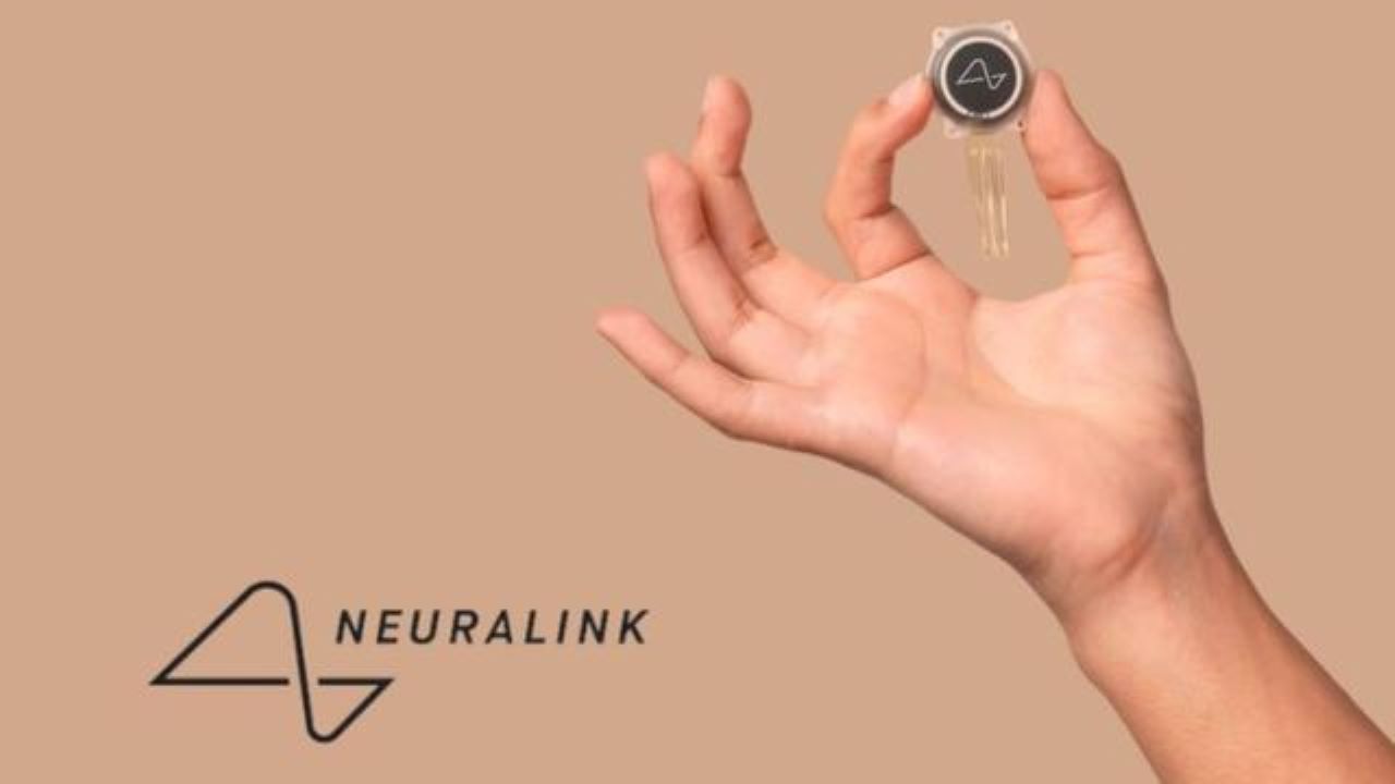 کاشت موفقیت آمیز دومین تراشه مغزی Neuralink در انسان