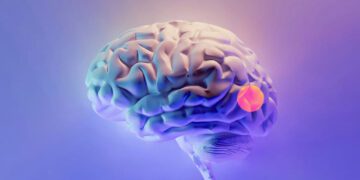 شناسایی تکه های باقیمانده تومور مغزی با هوش مصنوعی