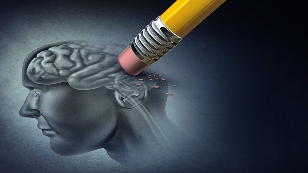 چینیها با جراحی جدید راهی برای درمان احتمالی بیماری آلزایمر یافتند