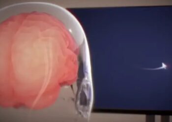 شرکت Neuralink مجوز مطالعه جدید خود را دریافت کرد