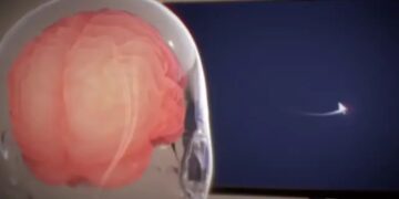 شرکت Neuralink مجوز مطالعه جدید خود را دریافت کرد