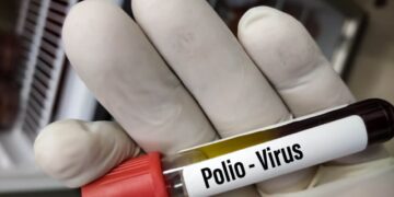 کشف ویروس فلج اطفال در ۳ کشور اروپایی