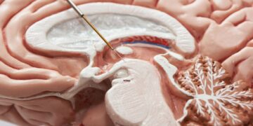 درمان نوآورانه پارکینسون با نانوذرات