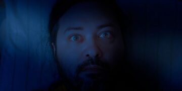 خوابیدن با چشمان باز رایج‌تر از چیزی است که فکر می‌کنید!