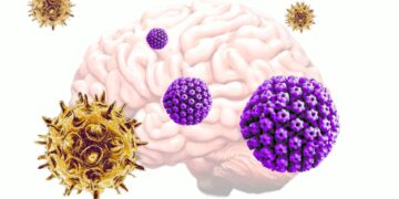 نقش دو ویروس رایج در شروع بیماری آلزایمر