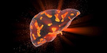 نقش یک مکمل ورزشی در بهبود سیروز کبدی آزمایش می شود