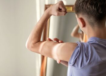 ارتباط مکمل‌های بدنسازی با اختلال دیس‌مورفی عضلانی