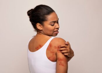 استرس عملکرد سلول‌های ایمنی را مختل می کند!