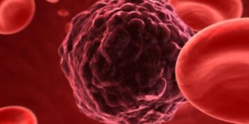 کدام سرطان ها بیشترین میزان مرگ و میر را دارند؟