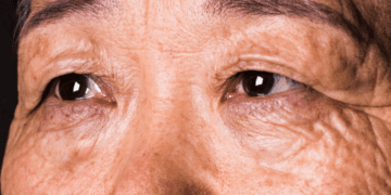 مشکلات بینایی شاید نشانه‌های اولیه زوال عقل باشند