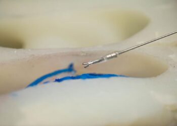 انقلاب در جراحی‌های مغزی با ابزارهای رباتیک پیشرفته