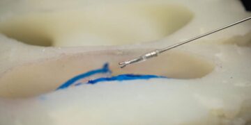 انقلاب در جراحی‌های مغزی با ابزارهای رباتیک پیشرفته