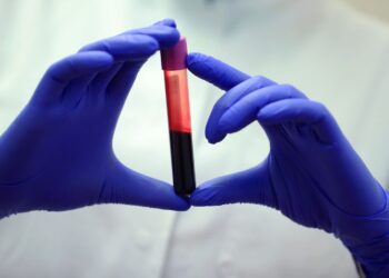 کشف راز طول عمر در سایه‌ ژنتیک و سبک زندگی