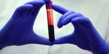 کشف راز طول عمر در سایه‌ ژنتیک و سبک زندگی