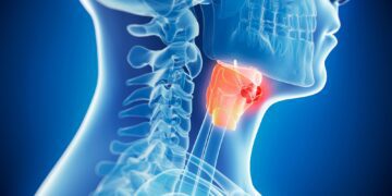 3 راه ساده برای کاهش خطر ابتلا به سرطان سر و گردن